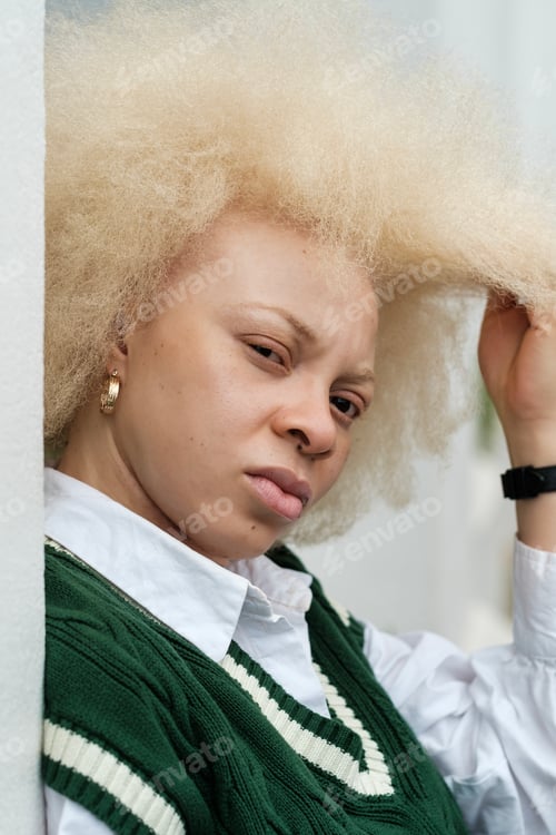 Preview: Albino black woman touching her afro hair, diversity and inclusion