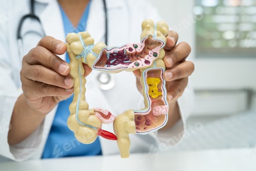 Preview: Intestine, appendix and digestive system, doctor holding anatomy