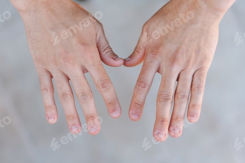 Preview: Two young man hands with ugly and bitten fingernails