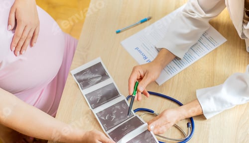 Caring Doctor Showing Ultrasound Scan to Pregnant Woman