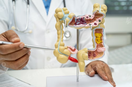 Preview: Intestine, appendix and digestive system, doctor holding anatomy model