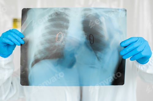 Preview: Epidemiologists in respirators examine the patient's pneumonia on a radiograph Covid-19. Concept