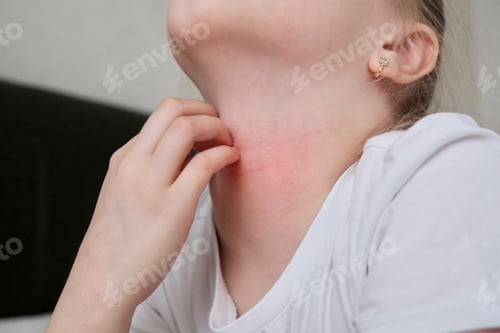 Preview: The child scratches atopic skin.