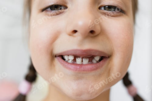 Preview: Close-up of smiling girl with missing teeth at home