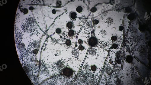 Preview: Hidden life of microscopic fungi