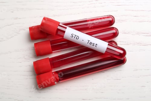 Preview: Tubes with blood samples on white wooden table, flat lay. STD test