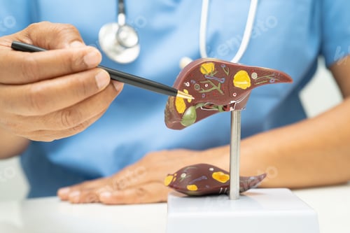 Preview: Cirrhosis, Liver cancer, fatty liver, Asian doctor with liver human anatomy
