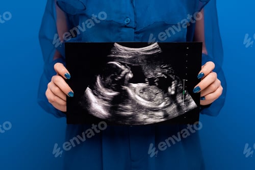 Preview: cropped view of woman holding ultrasound scan isolated on blue