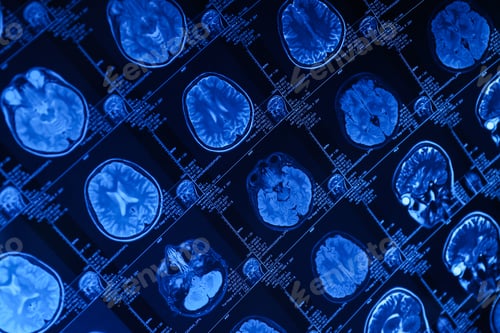 Preview: MRI or magnetic resonance imaging of the head and brain. Close up