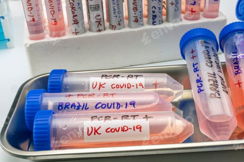 Preview: Several covid-19 positive research vials of the new Brazilian and UK variant