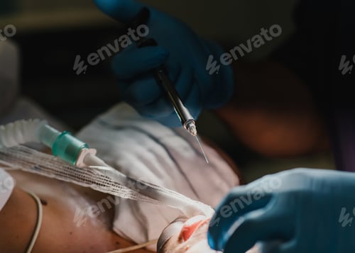 Preview: Surgeon doing rhinoplasty surgery inside operating room at private hospital