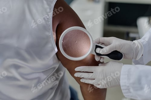 Preview: Middle Aged Black Woman Undergoing Dermatological Skin Examination by Doctor