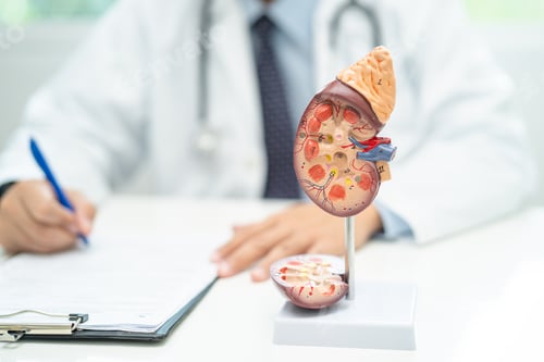 Preview: Kidney disease, Chronic kidney disease ckd, Doctor with human model to study and treat in hospital.