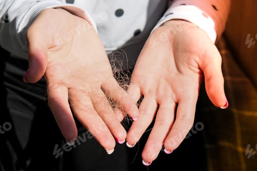 Preview: Female hand holding lost hair. Alopecia hair loss treatment concept, hair fall everyday serious prob