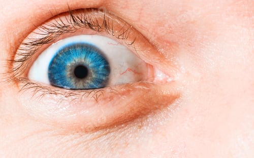 Preview: Close-up of wide open human eye, blue iris, vessels and capillaries, macro photography.