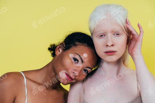 Preview: Group of multiethnic women