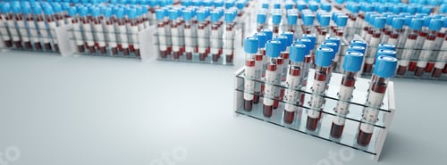 Preview: Coronavirus Covid19 test tubes in a rack. Medical screening and Covid tests production