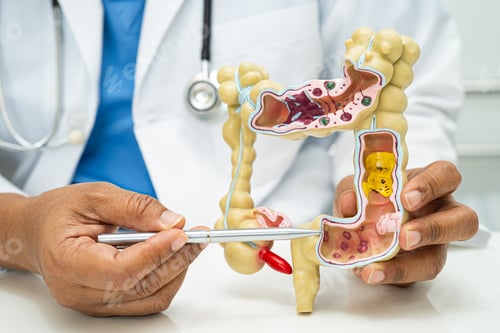 Preview: Intestine, appendix and digestive system, doctor holding anatomy model