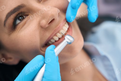 Preview: Close-up dentist in protective gloves using dental drill to remove tooth decay