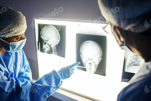 Preview: Dentist group, teeth x ray and together for analysis, study and learning in clinic for healthcare.