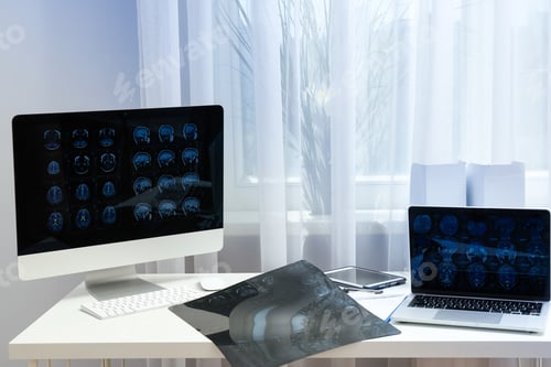 Preview: MRI images of the human head on a laptop and computer monitor