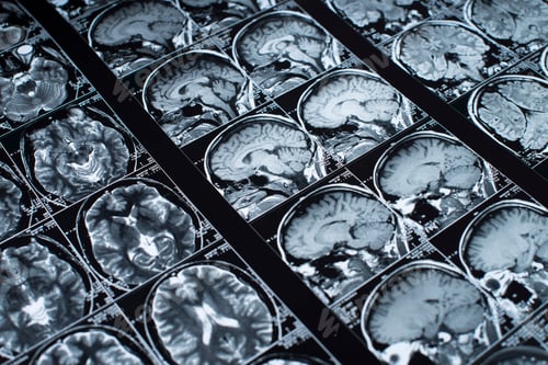 Preview: Magnetic resonance