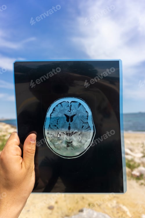 Preview: Vertical shot of a hand holding a transparent brain scan on a beach
