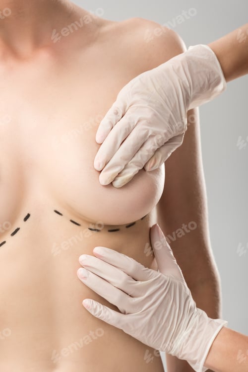 Preview: partial view of plastic surgeon in latex gloves and patient with marks under breast isolated on grey