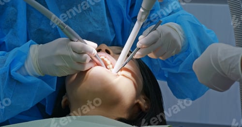 Preview: Woman wash teeth in the dental clinic
