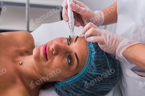 Preview: woman receiving mesotherapy treatment with dermapen on face by anonymous cosmetologist