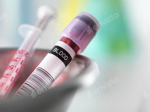 Preview: Blood sample taken for analysis with needle
