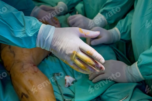 Preview: Patient injuries are treated through leg surgeries performed by orthopedic specialists.
