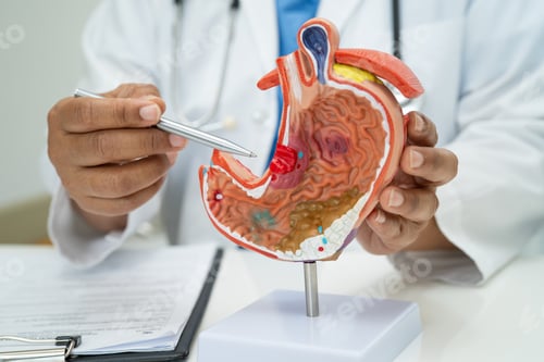 Preview: Stomach disease, doctor holding anatomy model for study diagnosis and treatment in hospital.