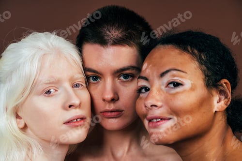 Preview: Group of multiethnic women