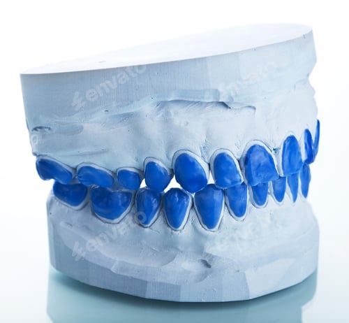 Preview: individual plaster dental molds to make trays