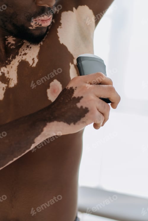 Preview: Cropped view of shirtless african american man with vitiligo using deodorant at home