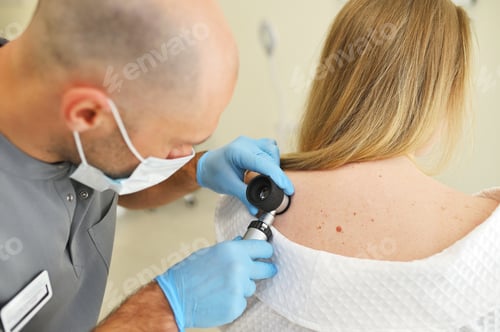 Preview: dermatologist examines neoplasms on the patient's skin using a special dermatoscope device