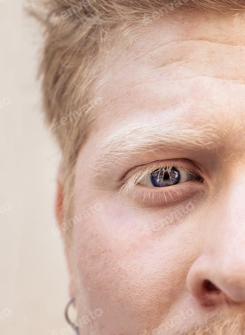 Preview: Close up portrait of an albino latino man