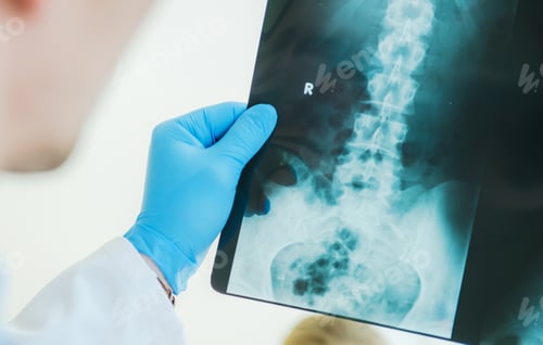 Preview: Radiologist Examining X Ray Image