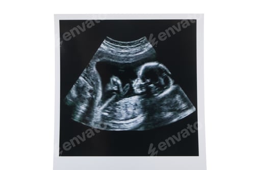 Preview: Concept of maternity, parenting, happy pregnancy period