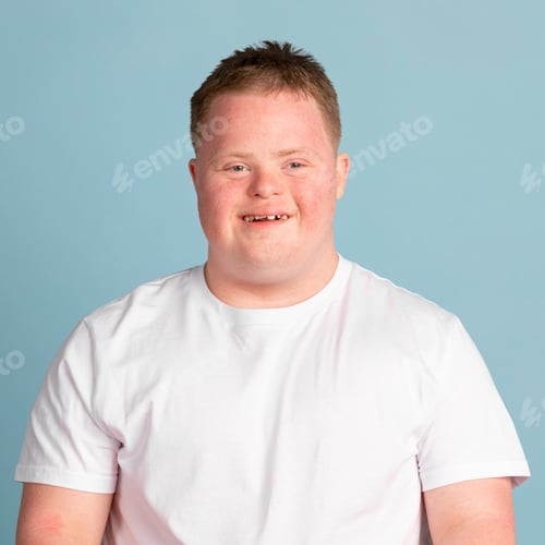 Preview: Cute boy with down syndrome
