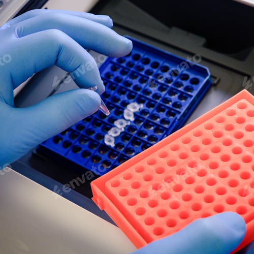 Preview: A laboratory worker arranging pipette tips in a blue container for a coronavirus testing
