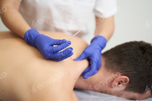 Preview: physiotherapist treating an overload with dry needling