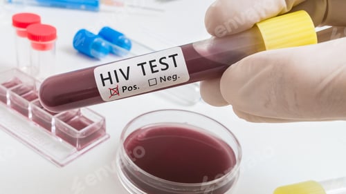 Preview: HIV virus, medical concept, Human Immunodeficiency Virus Positive test