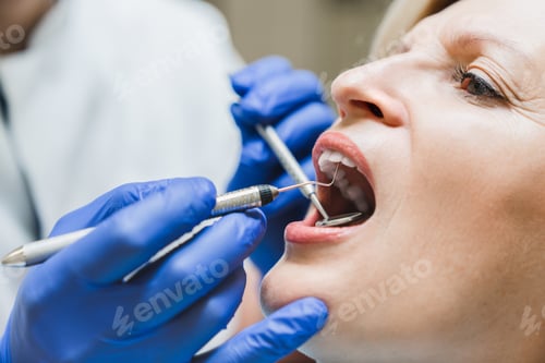 Preview: Female opened mouth with dental equipment mirror. Decay caries healing