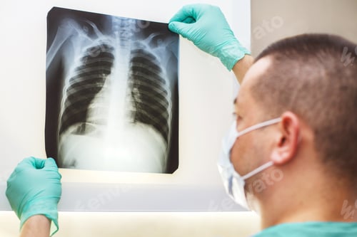 Preview: Man hand holding a lungs radiography isolated on a white background