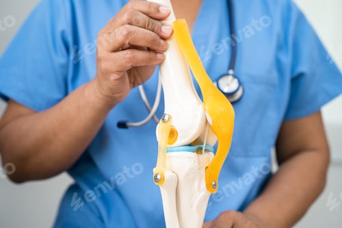 Preview: Osteoarthritis of the knee, Doctor holding human knee joint orthopedic anatomy model in hospital.