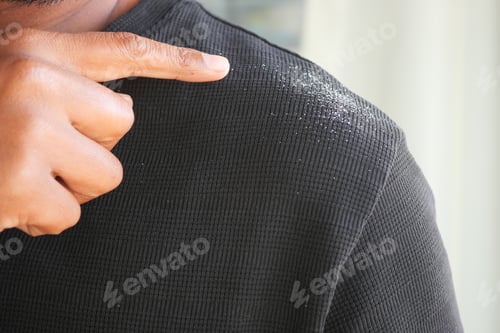 Preview: Man points to dandruff on his shirt while standing indoors