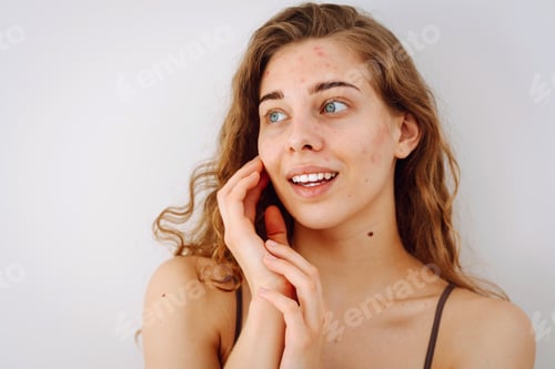 Preview: Close-up of a cute woman with problem skin looking in the mirror. Dermatology concept, allergy.