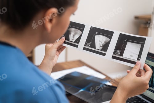 Preview: IVF Ultrasound Examination: close up doctor ultrasound results, recording notes on her laptop